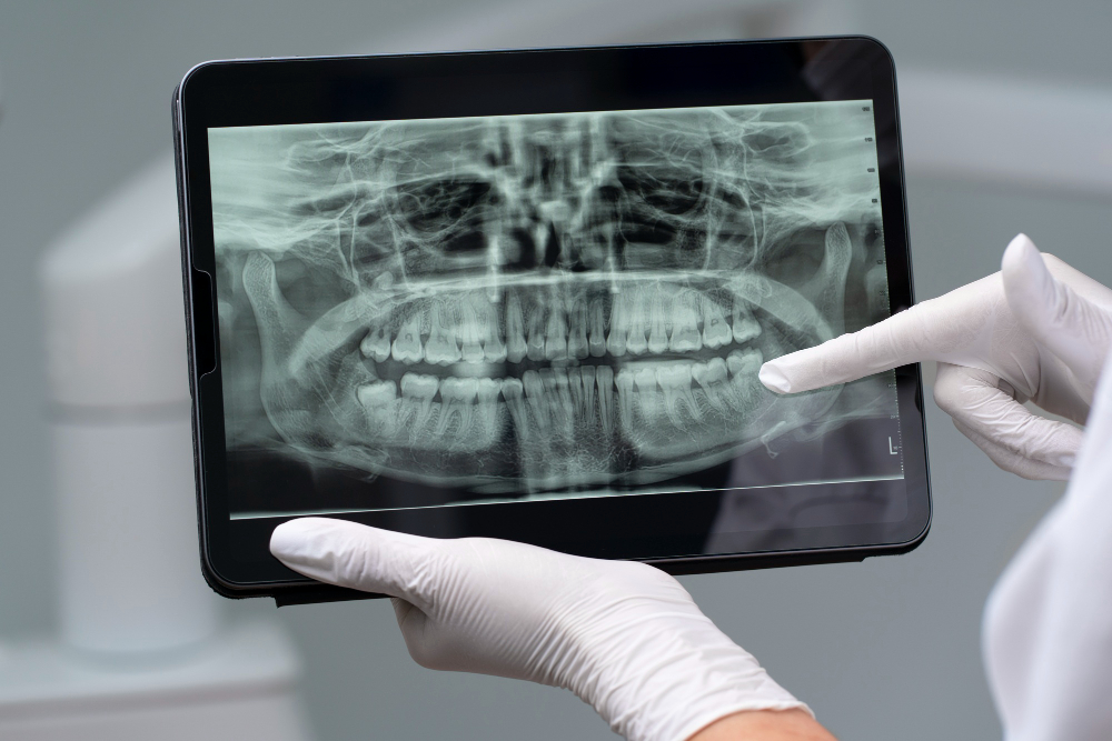 Dental X-ray