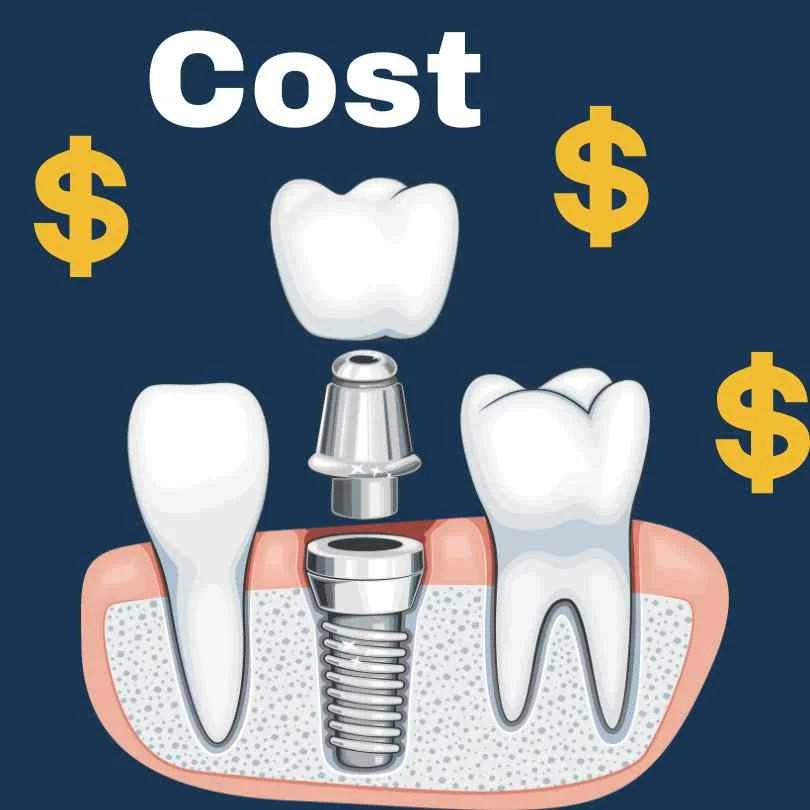 How Much Does Dental Treatment Cost in Abu Dhabi?