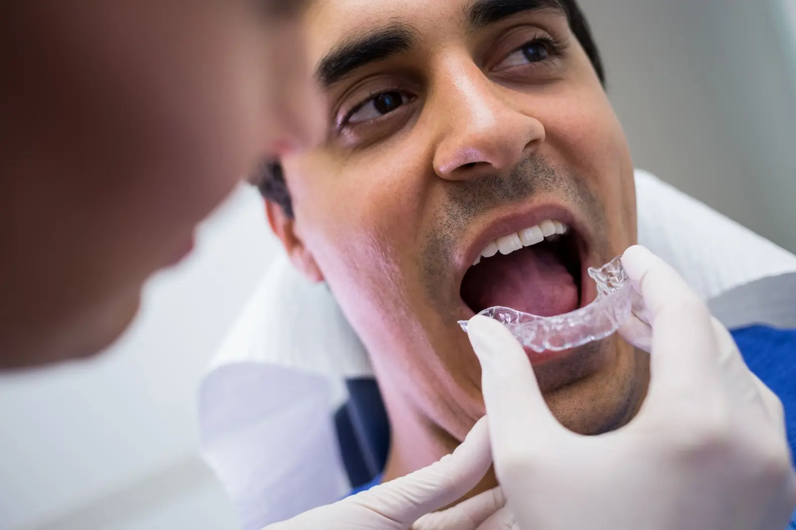 The Clear Aligner Treatment Process