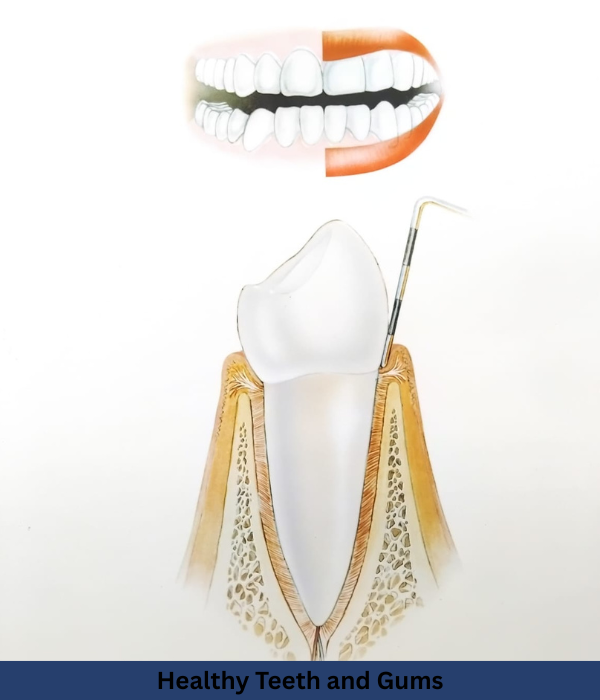 Gum Disease Treatment in Abu Dhabi: How Periodontists Help You Get Healthier Gums?(And A Better Smile)