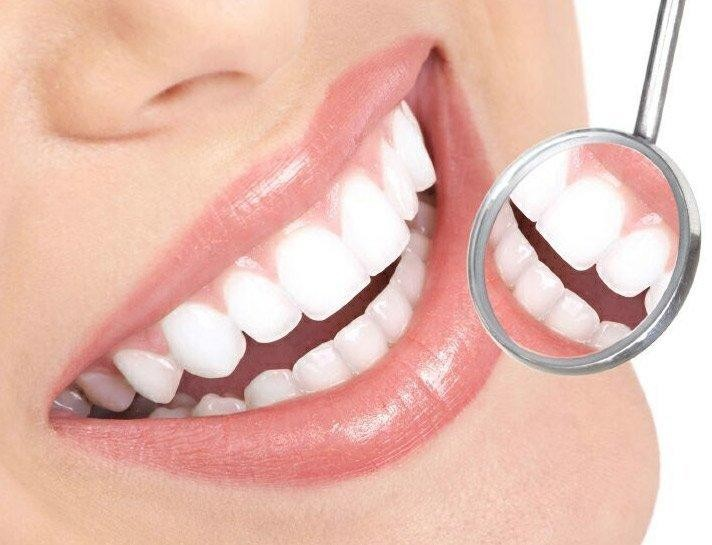 Smile Makeover 2026: Which Cosmetic Dental Treatment Is Right for You?