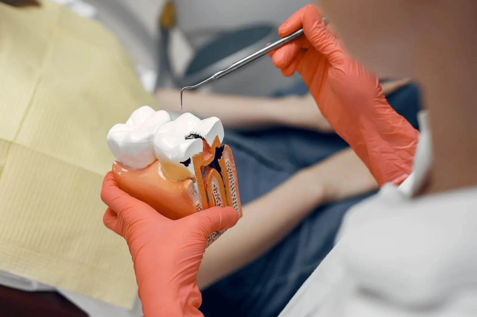 What Are the Types of Tooth Fillings